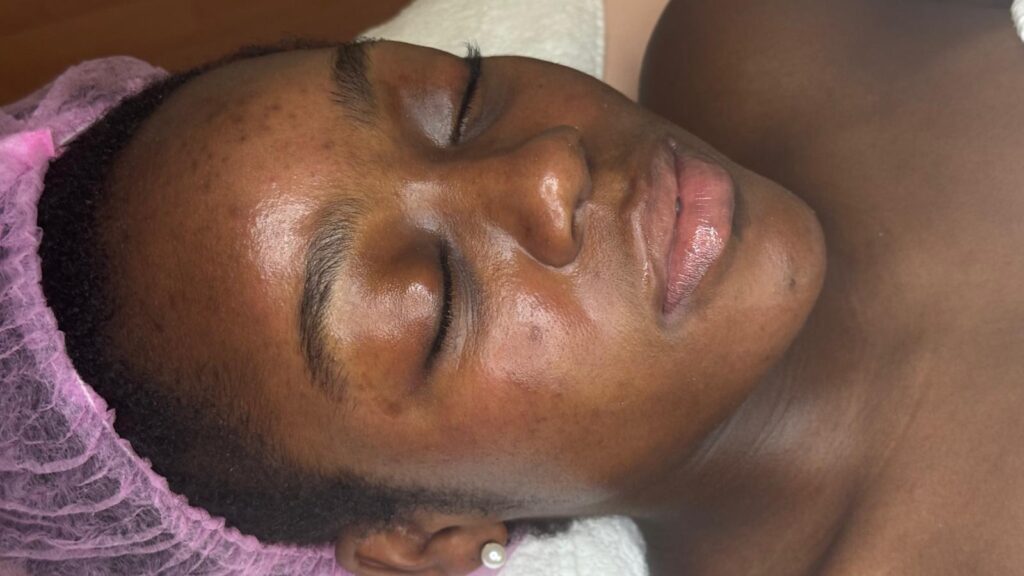 Customized facial