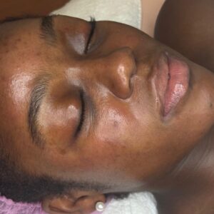 Customized facial