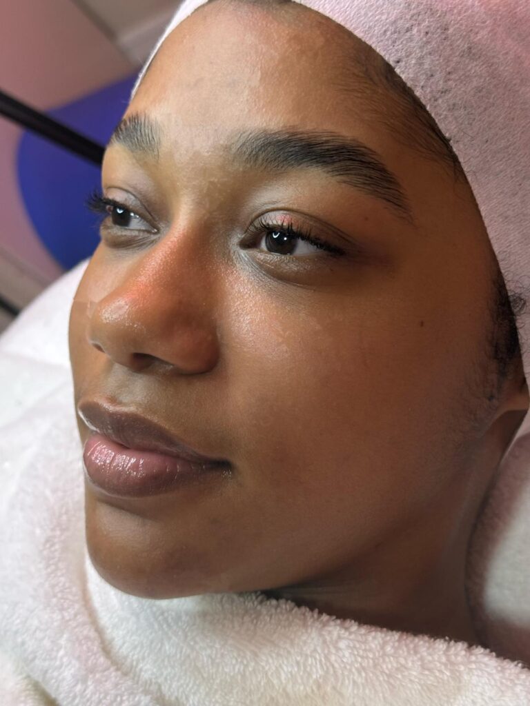Enzyme facial
