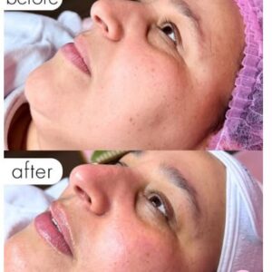 Signature facial